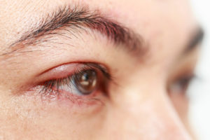 Eye Basics | Stuart P. Sondheimer, MD | Skokie, IL